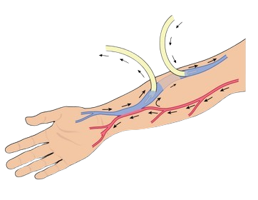 blood taken patient kidney failure 260nw 311615174 removebg preview